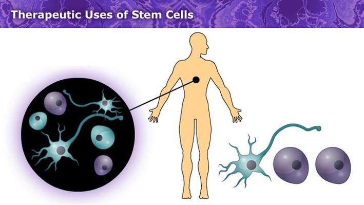 Stem cell therapy in diabetes essay
