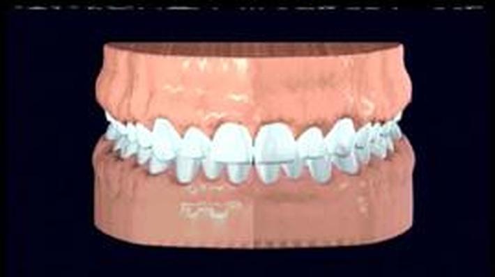 Teeth