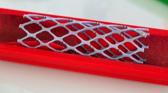 Study questions whether stents relieve chest pain