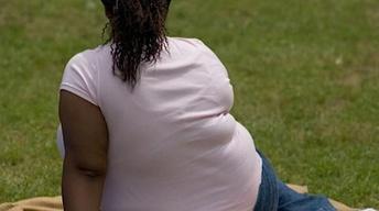 The Obesity Beast image