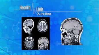 Xtra Dose | Parkinson's Disease
