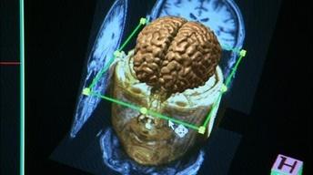 Scanning the Brain image