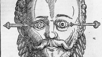 S1 Ep26: The Horrors of Ancient Cataract Surgeries