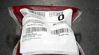 Cutting back on blood image
