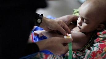 Malnutrition, a silent epidemic image