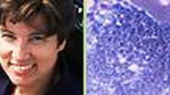 S3 Ep5: Leeches, The Search for ET, Stem Cells Breakthrough,