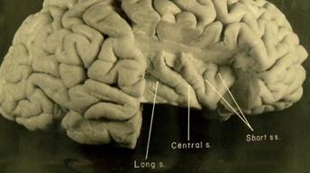 S6: New Photos of Einstein’s Brain