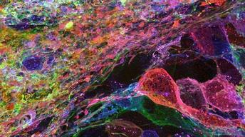 A New Way to See the Brain