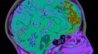 S43 Ep8: Alzheimer's Virus-Like Protein