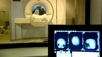 Brain Imaging