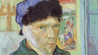 S16 Ep2: Van Gogh’s Ear