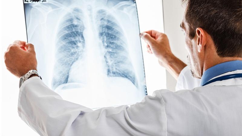 Health Link | Chronic Obstructive Pulmonary Disease