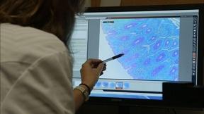 Image of In search of a cure, scientists look for where HIV hides