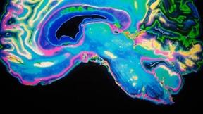 Image of Have We Been Brainwashed by Neuroscience?