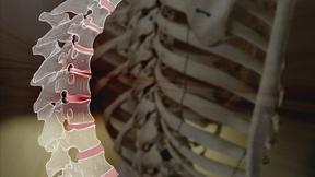 Image of Your Aching Back: A Gift from Your Ancient Ancestors