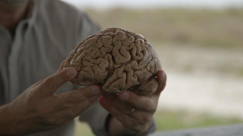 The 500-Million-Year History of the Human Brain