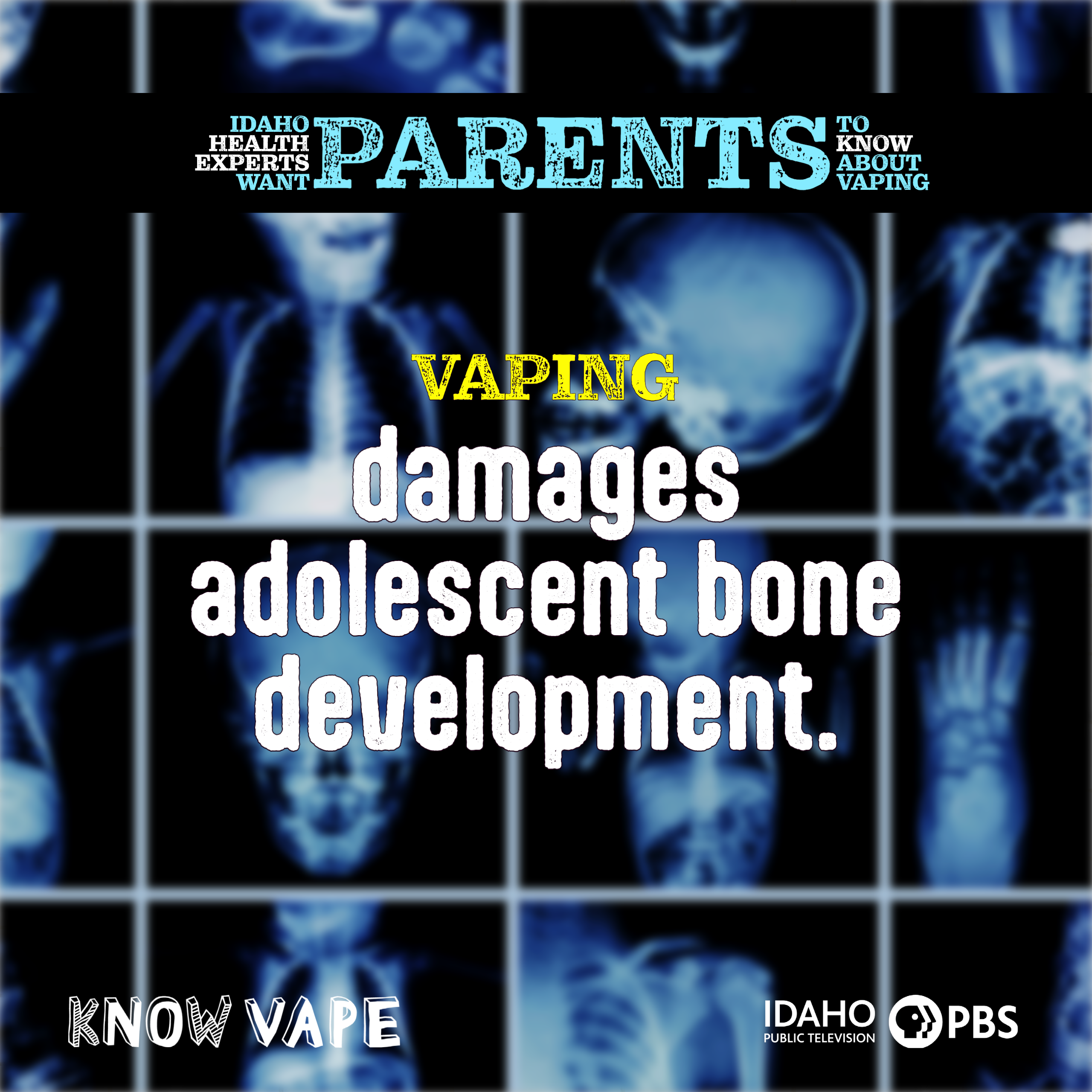 Clickable Social Media: Vaping damages adolescent bone development