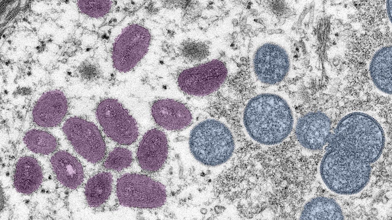 A close up image of the monkeypox virus.