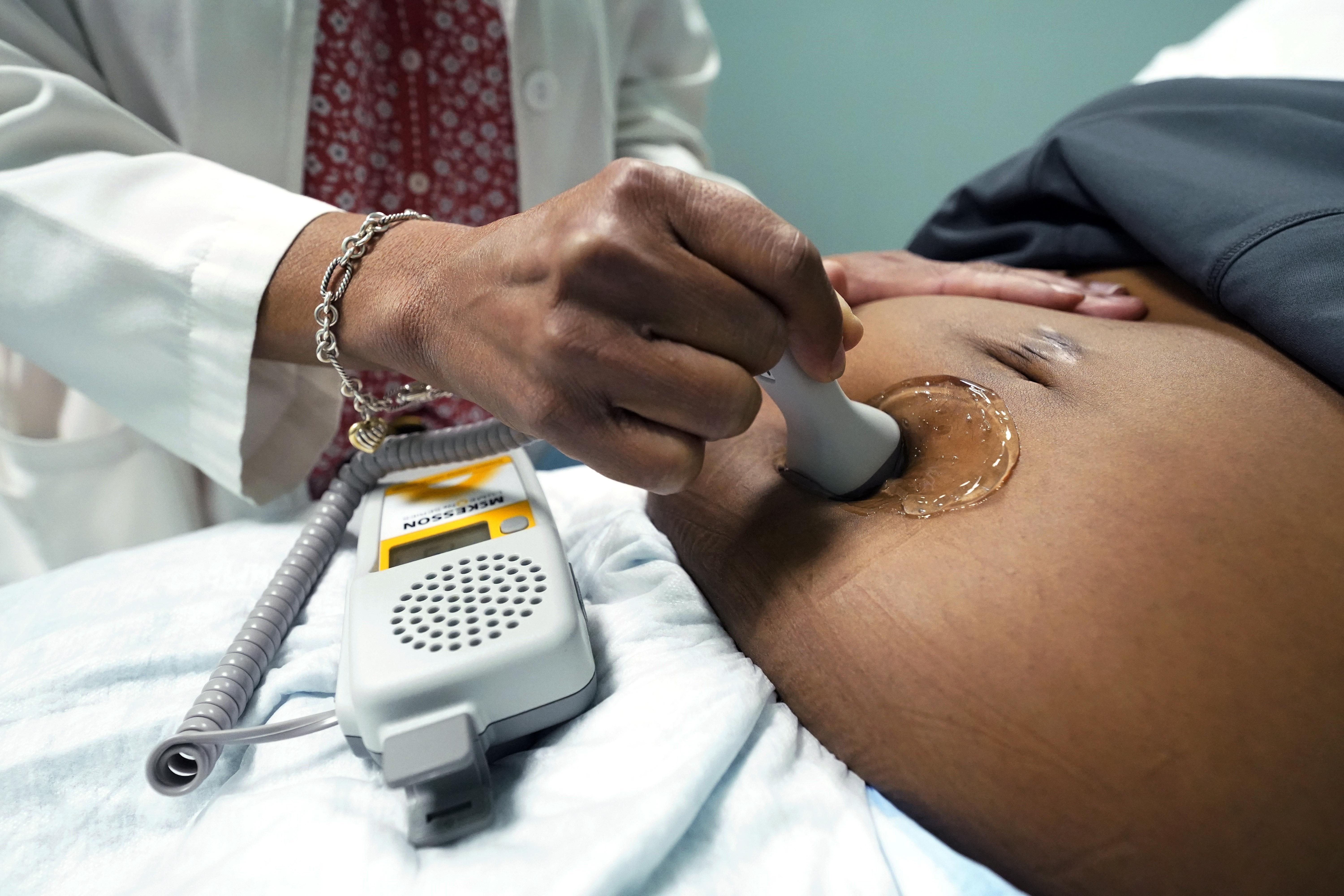 A doctor uses a hand-held Doppler probe on a pregnant woman to measure the heartbeat of the fetus on Dec. 17, 2021, in Jackson, Miss.