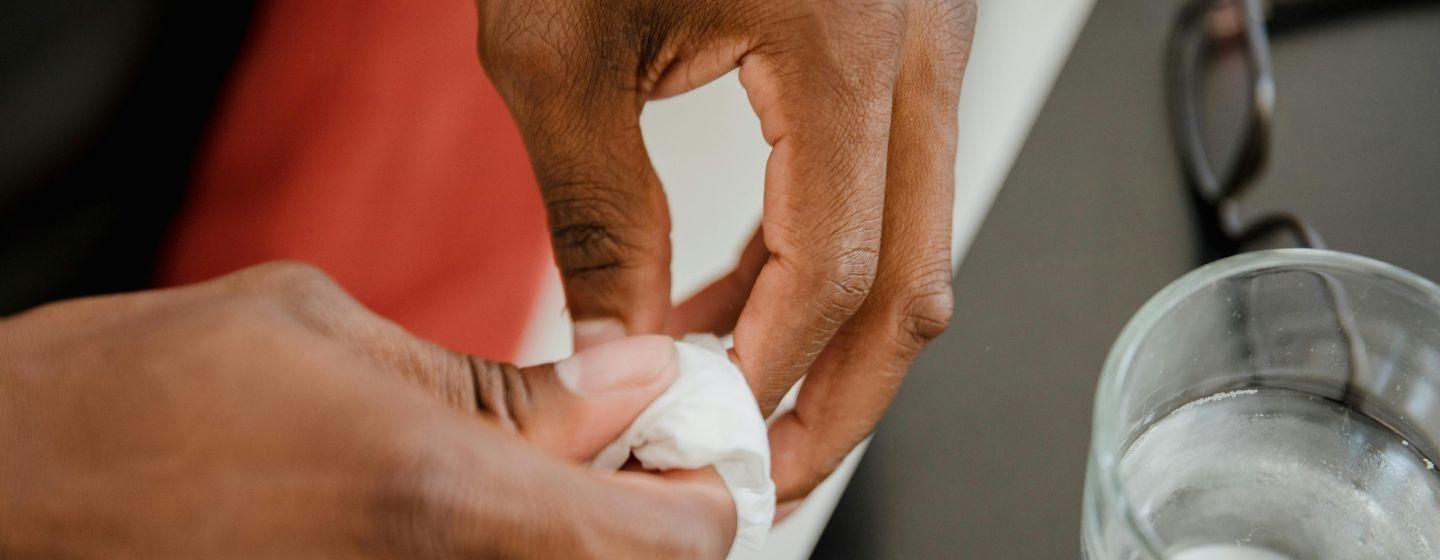 Closeup on hands holding gauze on a paper cut