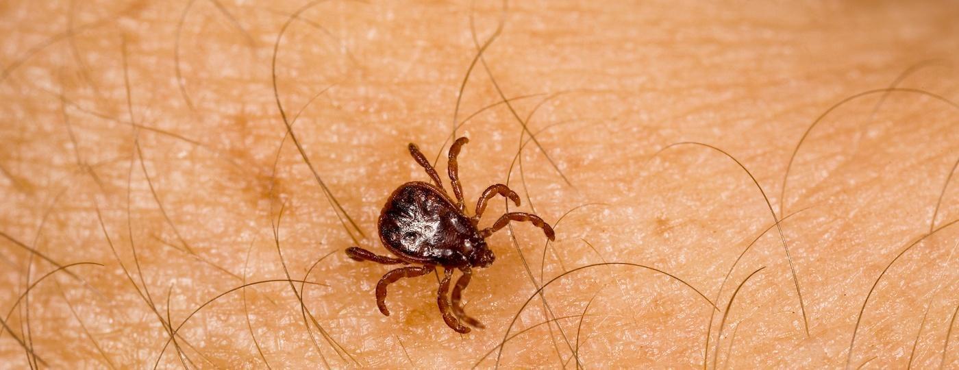 red tick close up crawling on skin between hairs