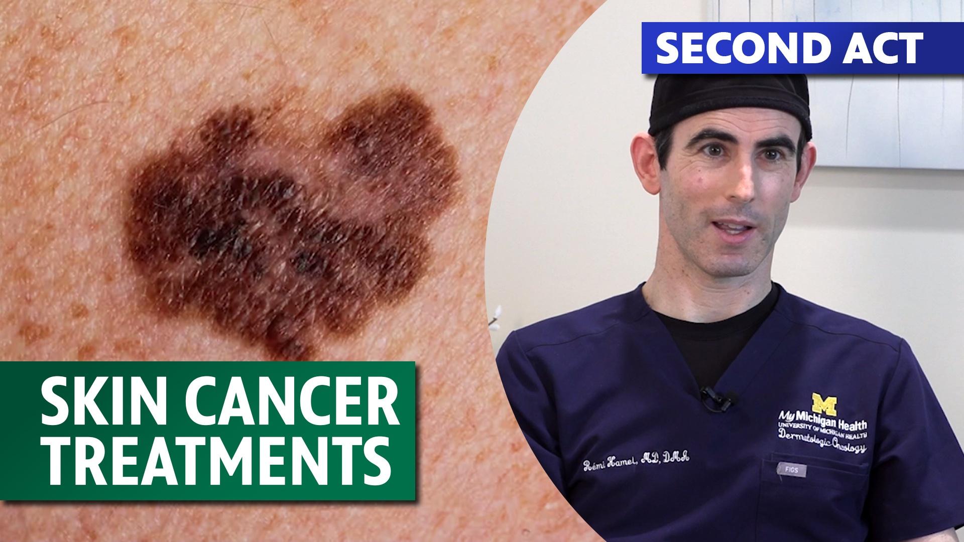 Second Act: Skin cancer treatments