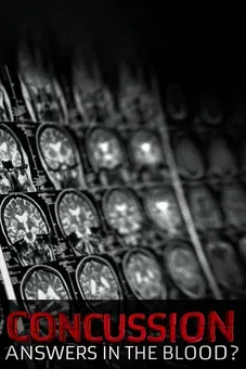 Concussion: Answers in the Blood?