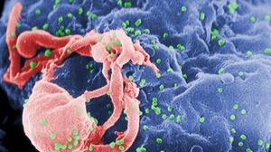 PBS NEWS : Injection Against HIV Offers ‘Stunning’ Protection