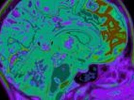 An Alzheimer's Virus-Like Protein