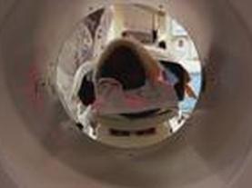 Alzheimer's Clinical Trials