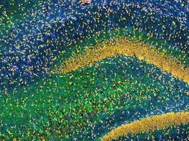 Memory-Enhancing Implants