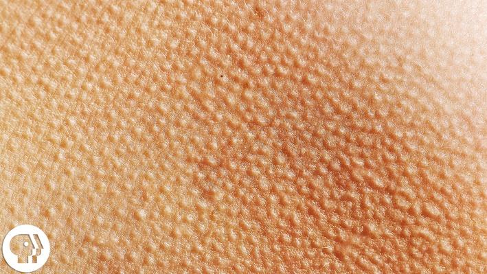 This Video May Give You Goose Bumps | Braincraft | Science | Video ...