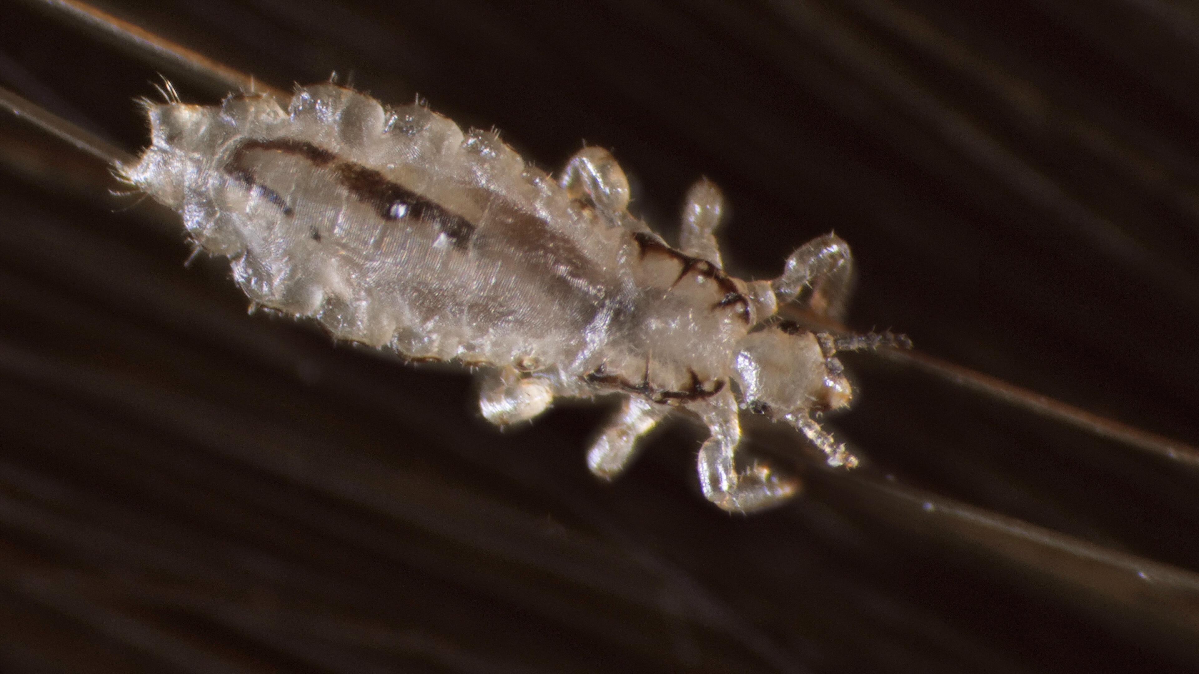 How Lice Turn Your Hair Into Their Jungle Gym Deep Look PBS