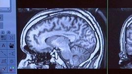 NOVA scienceNOW: Brain Trauma | PBS LearningMedia
