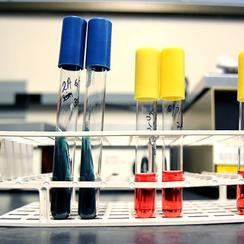 Resources For Lesson Plan For Science Pbs Learningmedia
