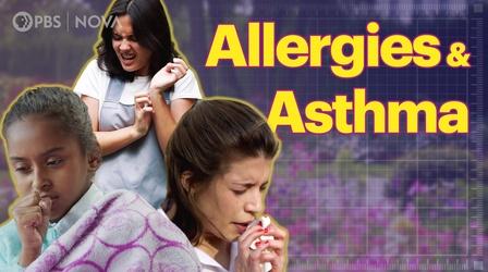 Video thumbnail: Parentalogic Understanding Allergies, Asthma, and Eczema