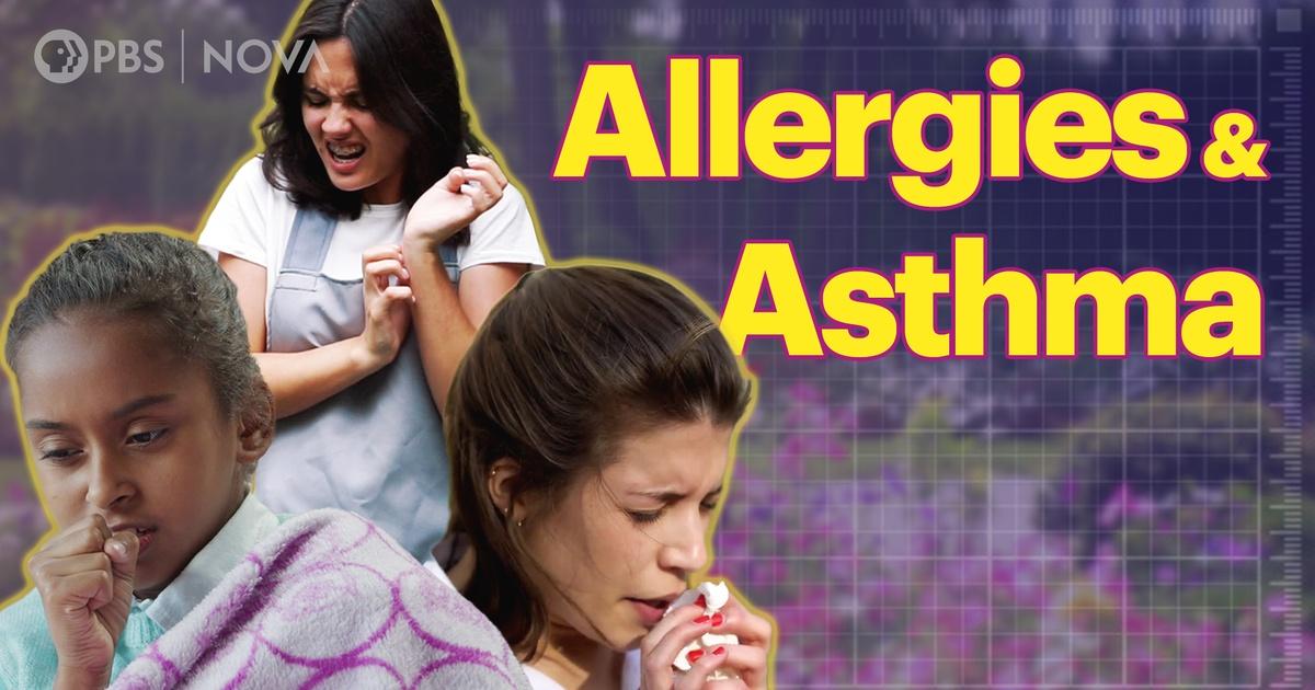 Parentalogic | Understanding Allergies, Asthma, and Eczema