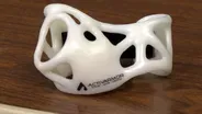 Your Health Checkup: 3D Casts