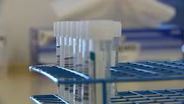 New BQ mutations could drive surge in COVID-19 cases
