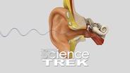 science trek hearing
