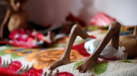 Video thumbnail: PBS NewsHour Yemen on brink of catastrophic famine orchestrated by Saudis