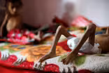 Yemen on brink of catastrophic famine orchestrated by Saudis