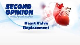 Heart Valve Replacement: asset-mezzanine-16x9