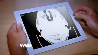 Coping with Brain Injuries - Preview