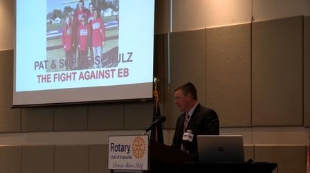 Video thumbnail: Evansville Rotary Club Regional Voices: Pat Schulz - Butterfly Disease