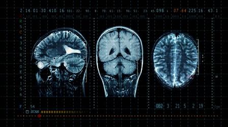 Video thumbnail: Opioids: State of Recovery Is Addiction a Choice?