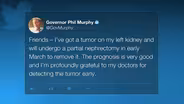 Governor reveals kidney tumor, says prognosis is 'very good'