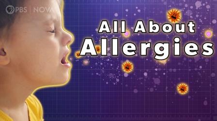 Video thumbnail: Parentalogic What are Allergies?