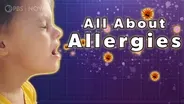 What are Allergies?