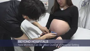 Northwestern Team Develops Wireless Monitors for Pregnancy